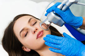 Scar Treatment — CO2 Laser
